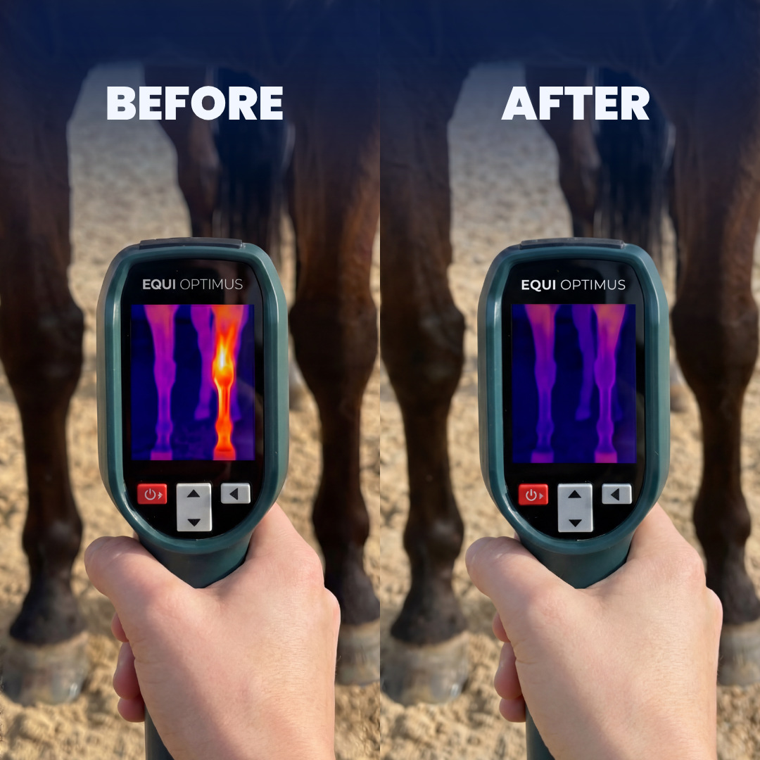 TrueScan — AI Thermal Inflammation Detector